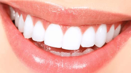Instant teeth whitening