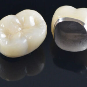Dental Metal Crowns