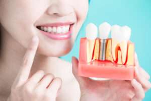 Dental-Implants-Permanent-Solution