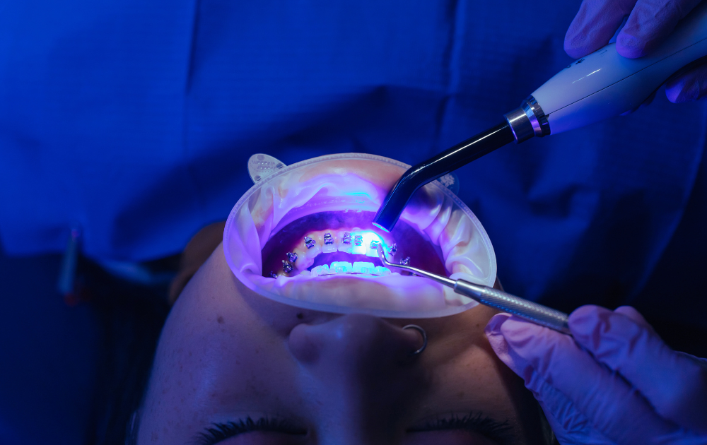 Common Myths About Orthodontic Treatments Debunked
