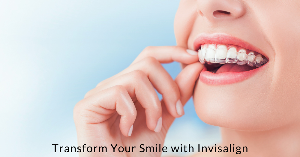 Invisalign in Ahmedabad
