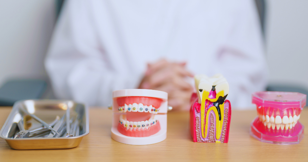 Which Teeth Treatment Is Best.